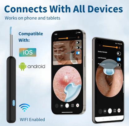 Imported Smart Visual Ear Cleaner Pro – 1080P HD Camera, Safe Silicone Tips & IP67 Waterproof Otoscope Kit
