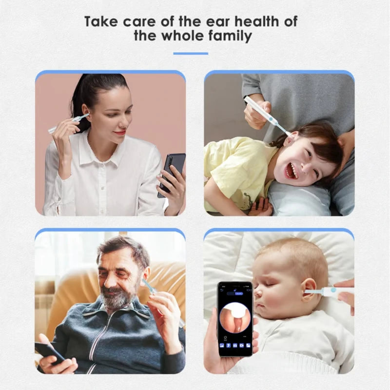 Imported Smart Visual Ear Cleaner Pro – 1080P HD Camera, Safe Silicone Tips & IP67 Waterproof Otoscope Kit